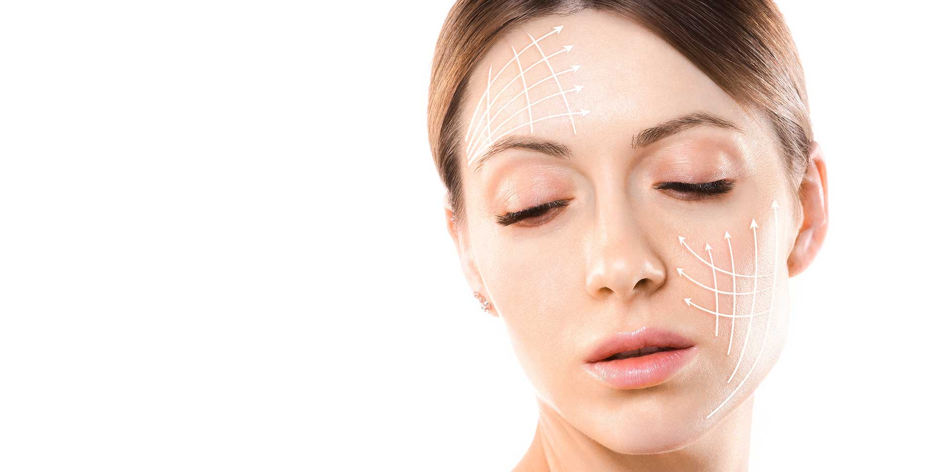 Pose de fils tenseurs à Libourne chez le dr Gautard