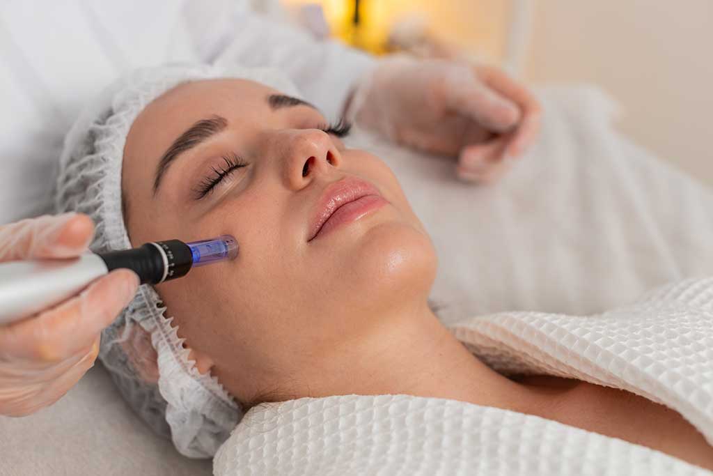 Microneedling à Liburne chez le dr Gautard